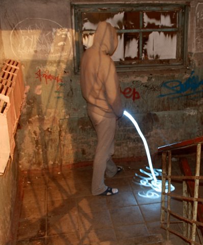 Гипервитаминоз