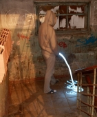 Гипервитаминоз